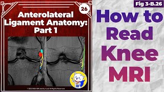 Fig 3B26 Anterolateral Ligament Anatomy [upl. by Lamont]