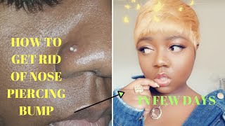 HOW TO GET RID OF NOSE PIERCING BUMP  SUPER FAST AND EASY IN LESS THAN A WEEK [upl. by Akcirred]