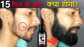 Beardo Hair Growth Oil After 15 Days Review  Best Beard Oil For Patchy Beard in India 2022 [upl. by Attenoj]