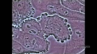 Mitosis in an animal cell Under the Microscope [upl. by Chadburn]