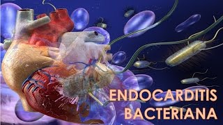 ENDOCARDITIS BACTERIANA  MEDICINA HUMANA [upl. by Anadroj]