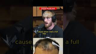 Logan Pauls CRAZY hair loss battle loganpaul hairloss balding [upl. by Ainitsirc71]