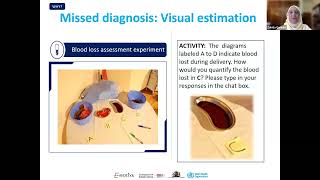 Advancing PPH management using the calibrated drapes amp a bundled approach of care [upl. by Leta]