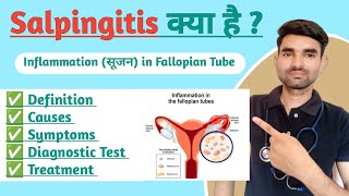 Salpingitis in Hindi  Causes Symptoms And Treatment of Salpingitis [upl. by Anauj]