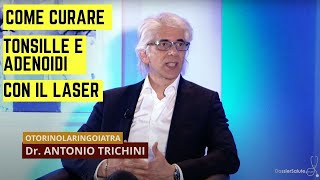 Tonsille e adenoidi come curarle con la chirurgia laser  Dott Antonio Trichini [upl. by Lebyram]