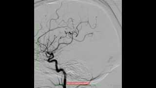 Circulação intracraniana [upl. by Ieppet]