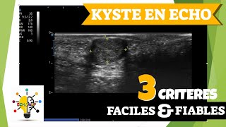 Diagnostiquer un kyste en échographie [upl. by Kucik]