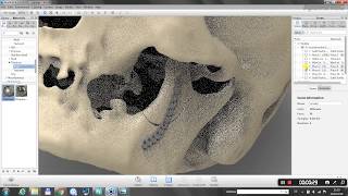 Custom Made Craniofacial Surgical Planning with Geomagic Freeform [upl. by Nereil820]