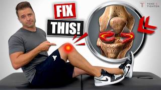 Fix Meniscus Tear Without Surgery Knee Pain Relief Exercises [upl. by Wendi]