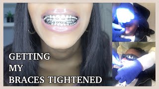 Getting My Braces TIGHTENED For The First Time  How To Prepare Yourself and What To Expect [upl. by Adleremse]