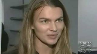 Skinny Model Filippa Hamilton I Was Fired For Being Too Fat wcco com [upl. by Eirised]