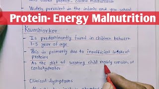 Protein  Energy Malnutrition  Kwashiorkor  Marasmus  Biochemistry [upl. by Shipley]