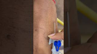 LOCATING DIFFICULT VEINS FOR IV CANNULATION  IV CANNULA [upl. by Sinnaiy744]