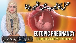 What is Ectopic pregnancy  Risk factorssymptoms and Treatment of Ectopic Pregnancy by Dr Zainab [upl. by Brieta579]