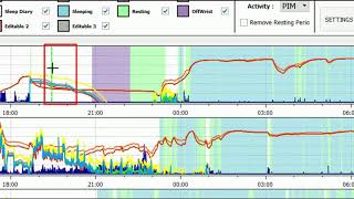 ActStudio Tutorial 10  Sleep Scoring Action Menu [upl. by Aliemaj649]