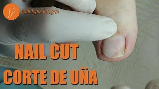 Nail cut Podología Integral Integral Podiatry [upl. by Hourihan]