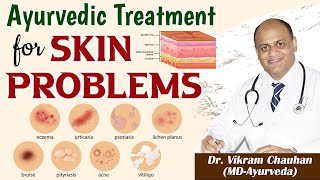 Ayurvedic Treatment for Skin Problems Complete Skin Care Package [upl. by Anirehtac141]