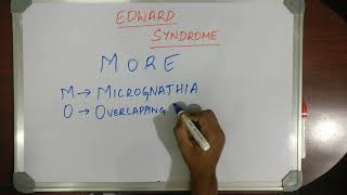 MEDICAL MNEMONIC POCKET EDWARD SYNDROME [upl. by Aztilay]