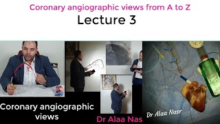 Coronary angiographic views 03 Dr Alaa Nasr Egypt 2020 [upl. by Akkimat312]