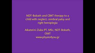 NDTBobath therapy combined with CIMT therapy [upl. by Annairdua653]