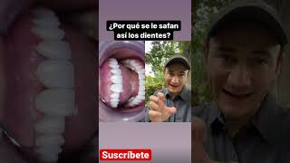 ¿Por qué se le caen así los dientes [upl. by Ramberg]