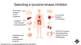 Strategies in Chronic Myeloid Leukemia The Evolving Treatment Landscape [upl. by Nylcsoj691]