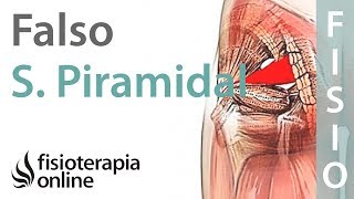 Síndrome del piramidal ¿Cómo diferenciar un caso falso de uno verdadero [upl. by Akiv481]