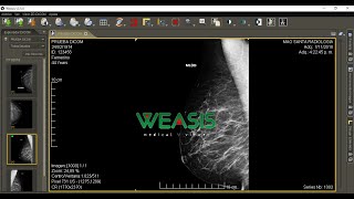 Weasis for Dcm4chee Mac OS [upl. by Eecyal274]