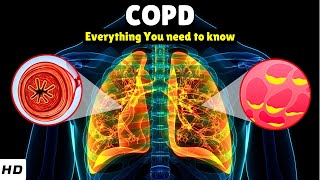 What is COPD – Causes Signs and Symptoms Diagnosis amp Treatment [upl. by Ennayehc138]