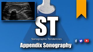 Appendix Ultrasound [upl. by Zamir202]