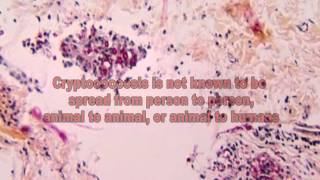 Cryptococcus Fungi The Cause of Cryptococcosis [upl. by Feinleib]