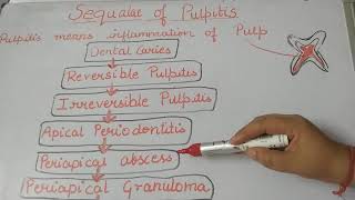 Pulpitissequalaeofpulpitislecture1dentalnotes [upl. by Garold]