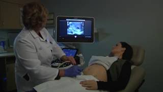 Your First OB Ultrasound  Oakdale OBGYN [upl. by Esiuole]