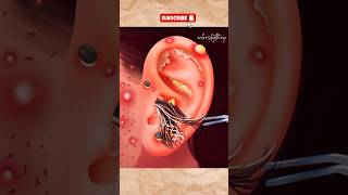 ASMR Ear cleaning asmr asmrvideos satisfying asmrsleeptingles asmrtriggers viralvideo [upl. by Kcirded]