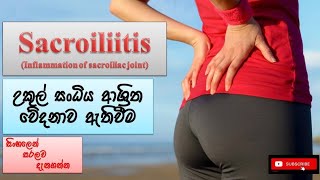 Sacroiliitis උකුල් සංධියේ වේදනාව how it happens causes symptoms treatment how to prevent [upl. by Isewk44]