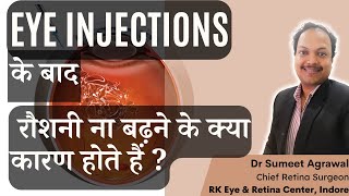 EYE INJECTION के बाद क्या रौशनी नहीं बढ़ी  जानिये इसके कारण [upl. by Misab]