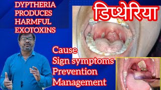 DIPTHERIA डिप्थेरिया बैक्टीरिया में जानलेवा EXOTOXINS infectiousdisease [upl. by Campman16]