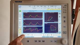 Programación Velocidad de flujo según VT  tiempo inspiratorio  según VT  flujo [upl. by Padraic]