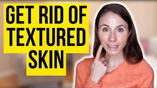 How To Get Rid Of Textured Skin On The Face  Dermatologist Tips [upl. by Bardo]