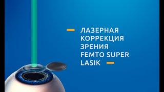 Фемто Супер ЛАСИК Femto Super LASIK  операция лазерной коррекции зрения [upl. by Everest]