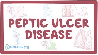 Peptic ulcer disease  causes symptoms diagnosis treatment pathology [upl. by Burch616]