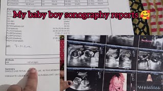 my baby boy sonography reports 🥰 heart beat rate 🥰 [upl. by Chapland]