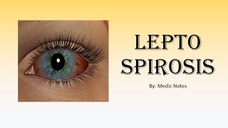 Infectious disease Leptospirosis conjunctival suffusion investigation treatment [upl. by Reinert226]