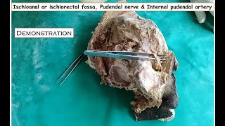 Ischioanal or Ischiorectal fossa Pudendal nerve amp Internal pudendal artery dissection Demonstration [upl. by Adnauqaj]