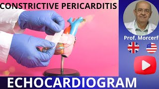 How to Escape the Grip of Constrictive Pericarditis Echocardiography Diagnose [upl. by Frentz]