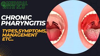 chronic pharyngitis types PATHOPHYSIOLOGY TREATMENT  DIAGNOSIS etc pharyngitis medical [upl. by Jeuz]