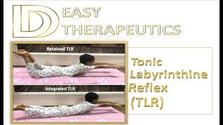 TLR Assessment and Exercises  Tonic Labyrinthine Reflex  Primitive Reflexes [upl. by Doug]