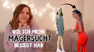 Meine Essstörung  Storytime amp Tipps 🤍 [upl. by Mandeville]