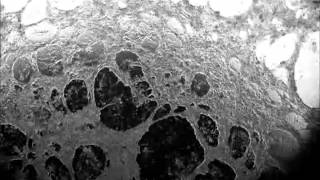 Spontaneous contraction of cardiomyocytes differentiated from End2induced precardiac mesoderm [upl. by Elletsyrk985]