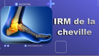 IRM de la cheville Bonne Pratique [upl. by Brandon267]